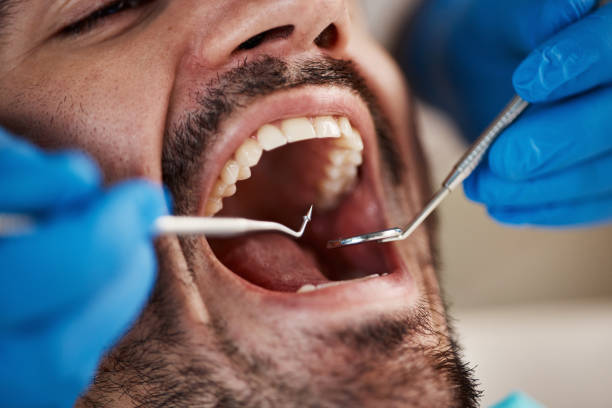 Best Emergency Gum Treatment in Suffield Depot, CT
